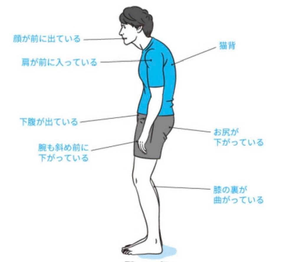 猫背と闘う日々